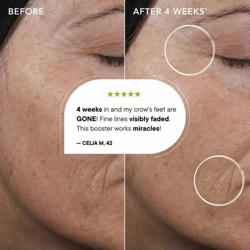 Retinal Tightening Booster-11× Faster Than Retinol — Without 11× Irritation.