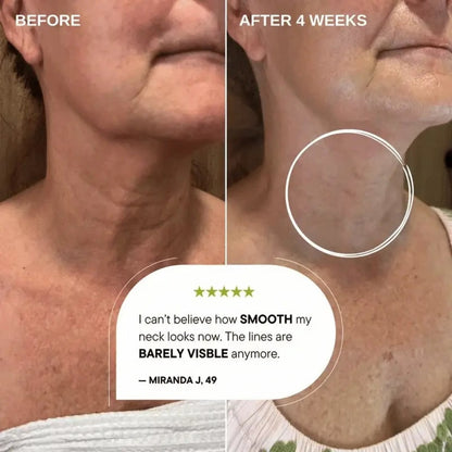 Retinal Tightening Booster-11× Faster Than Retinol — Without 11× Irritation.